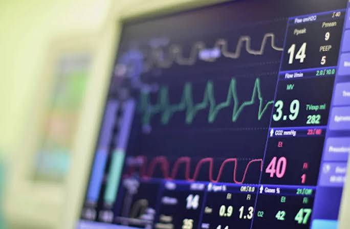 مانیتورینگ آنلاین بیماران در ICU و تشخیص بحران قلبی یا تنفسی
